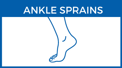 Ankle sprain