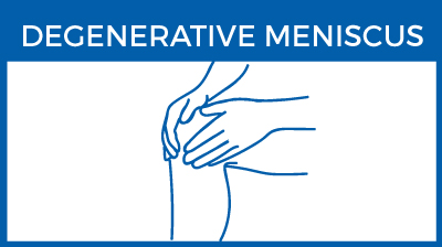 Degenerative meniscus