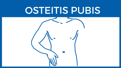 Osteitis pubis