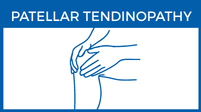 Patellar tendinopathy