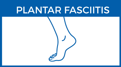 Plantar fasciitis