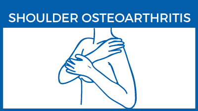 Shoulder osteoarthritis